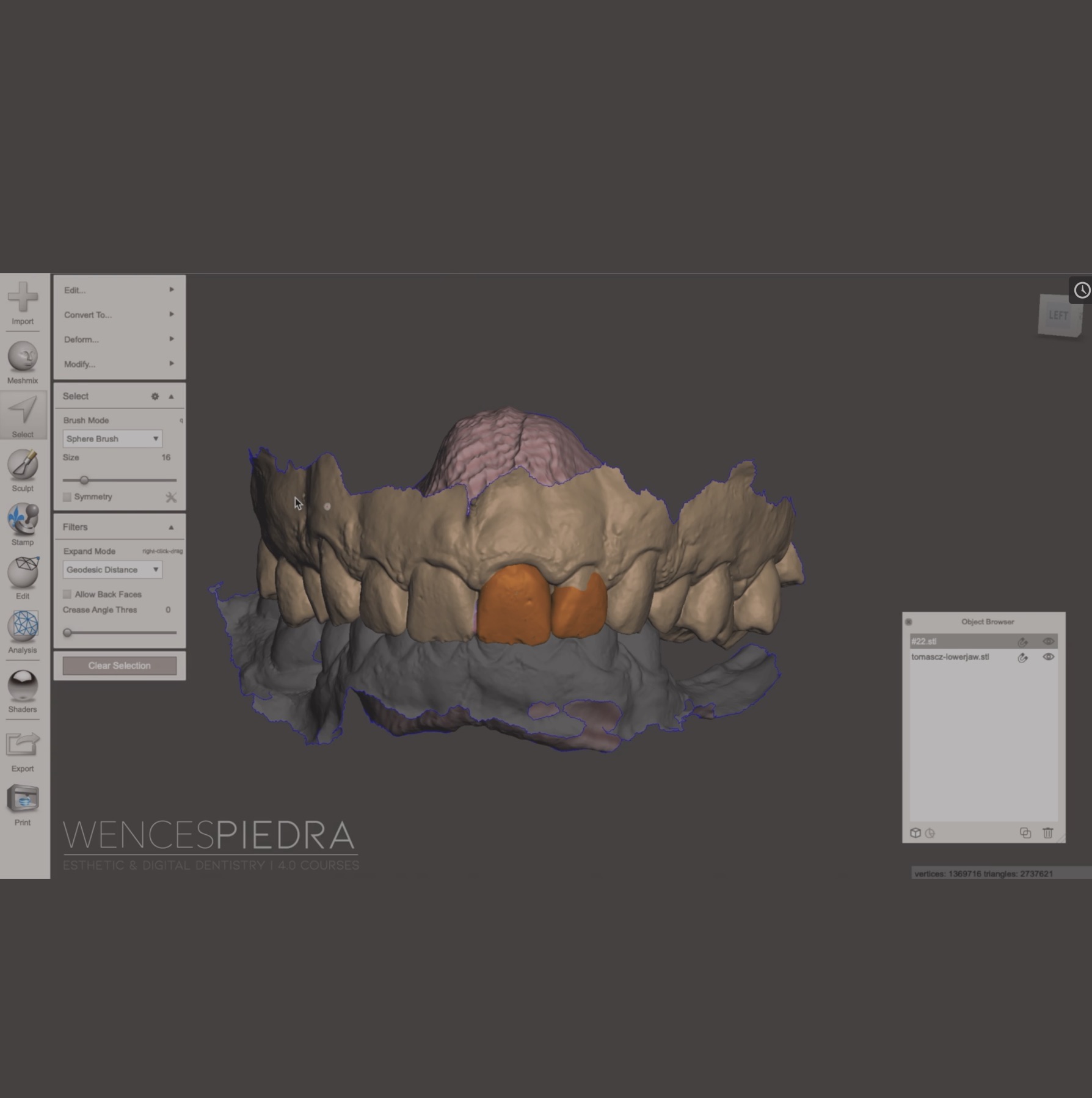 Empezando en Odontología y Softwares CAD 3D: Meshmixer
