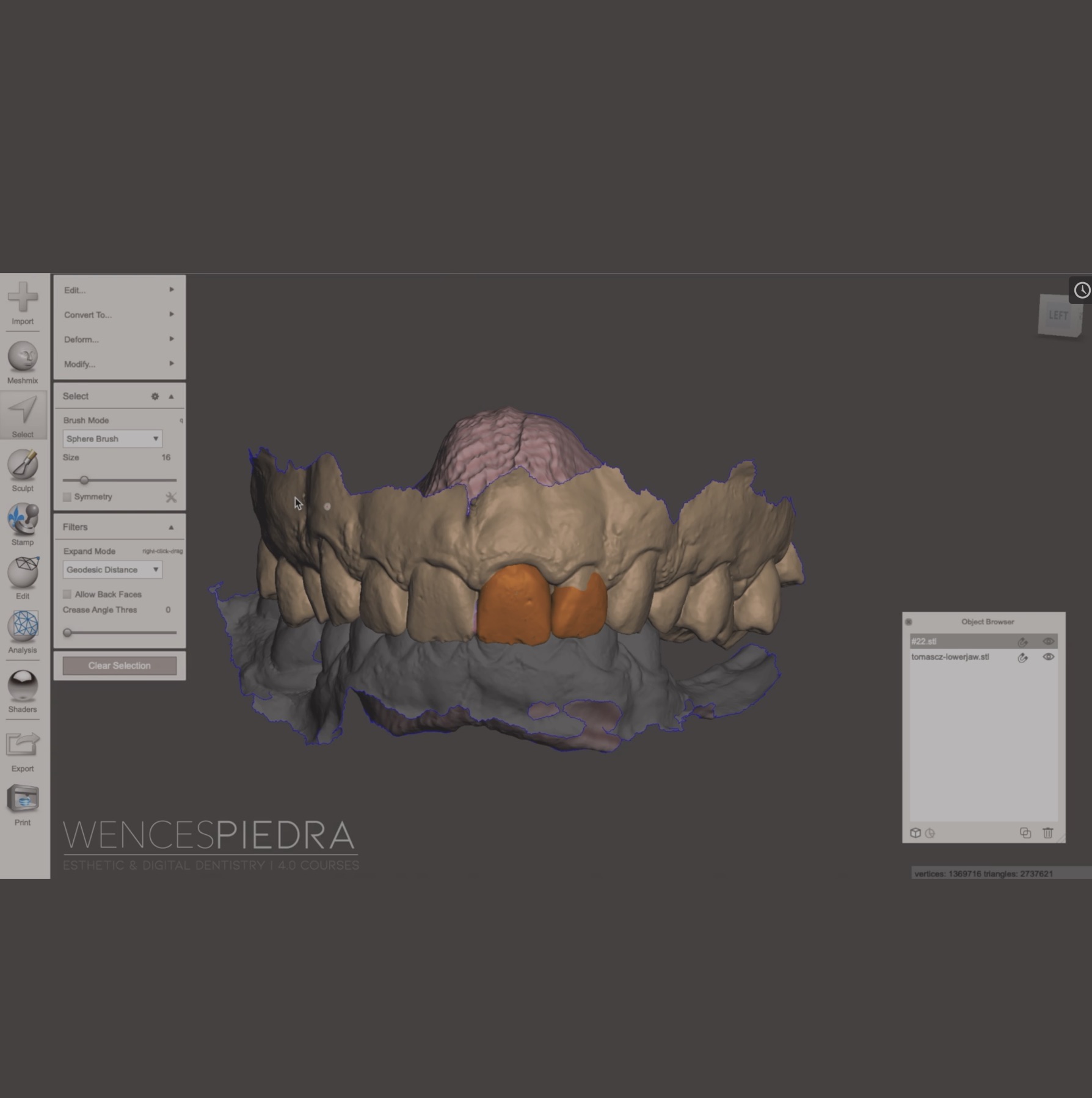 Lee más sobre el artículo Empezando en Odontología y Softwares CAD 3D: Meshmixer